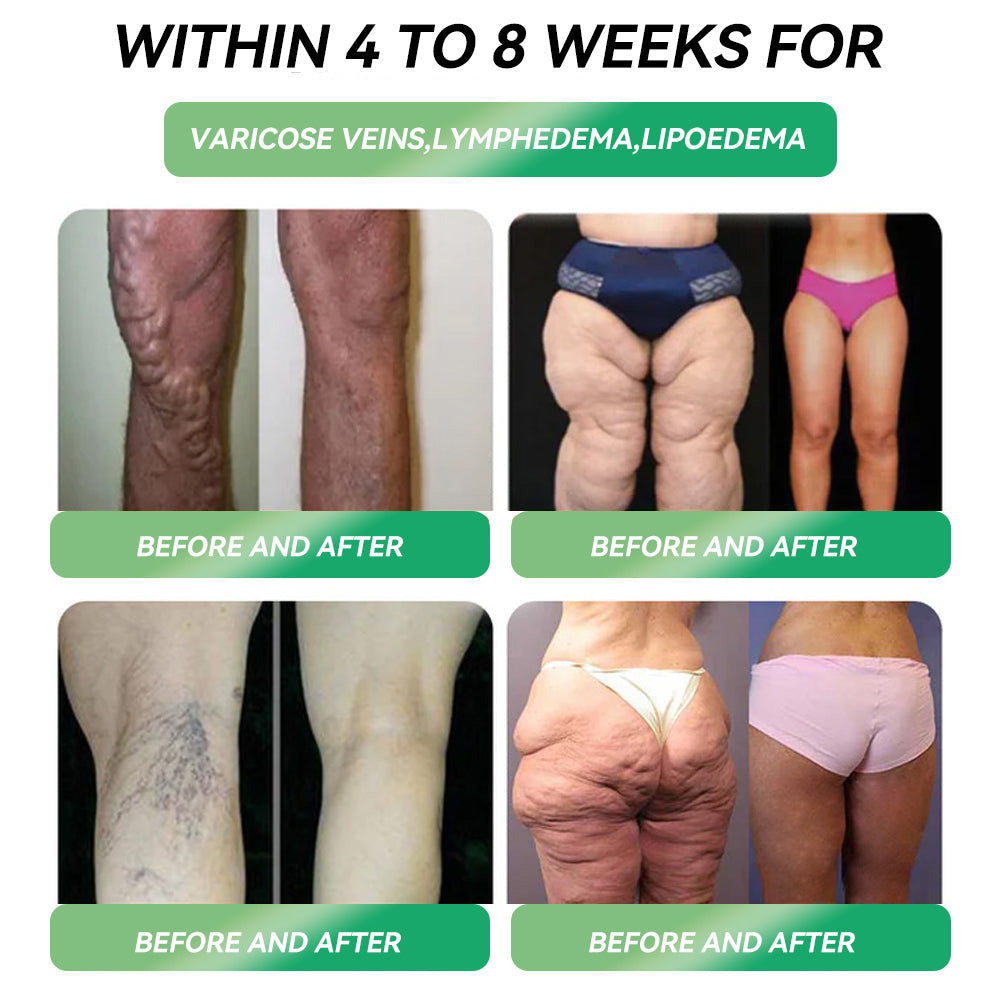 Persistence = Results! 30% HHVB discount for a limited time. Many users choose to purchase 6 boxes at a time (60 DAYS usage) as this not only stabilizes the results, but also allows them to take advantage of the awesome combo offer!